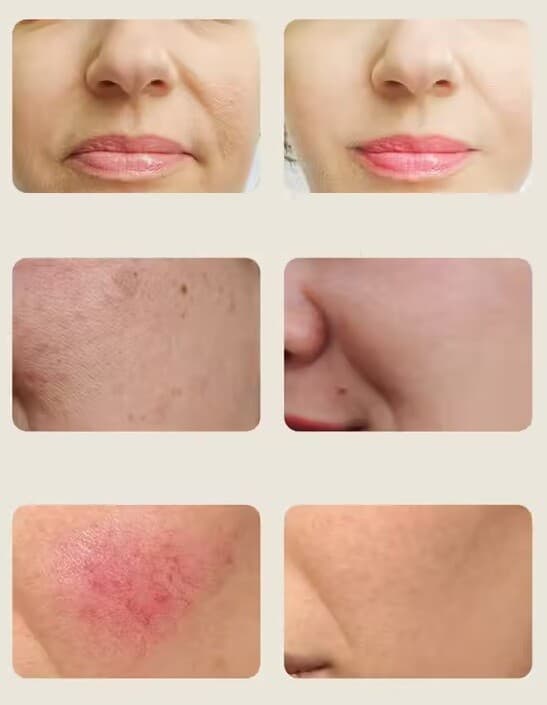 LED mask 7 färger ansikte infraröd - bild 7